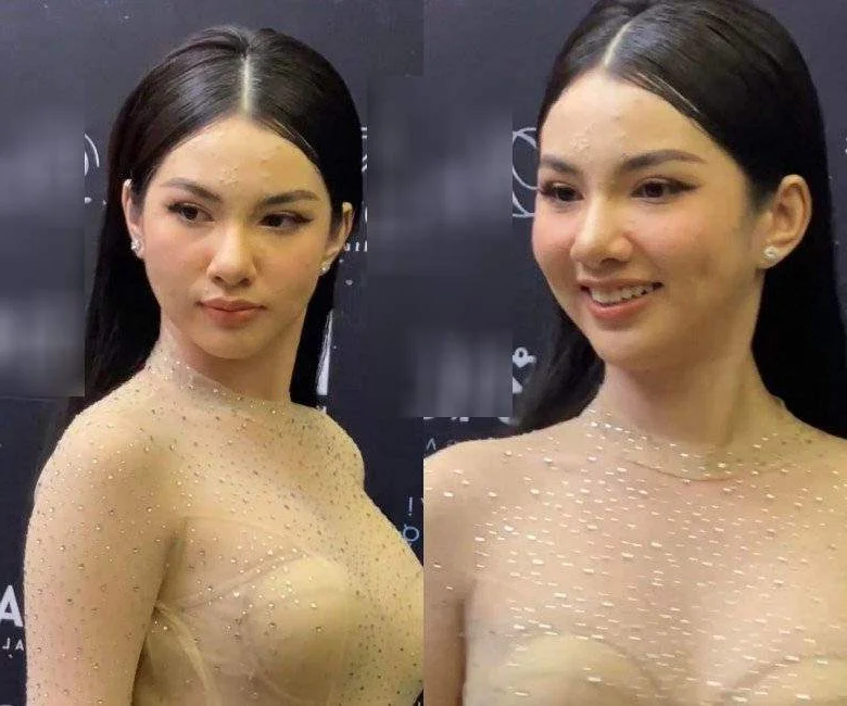 Social Media vs. Reality: The Truth Behind Flawless Beauty and Real Skin Struggles
