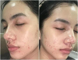 Social Media vs. Reality: The Truth Behind Flawless Beauty and Real Skin Struggles - image 4