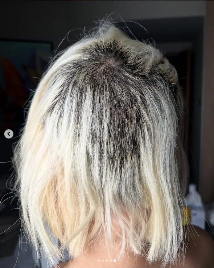 DJ Soda’s Hair Nightmare: South Korea’s Famous DJ Opens Up About Emotional Hair Damage Struggles