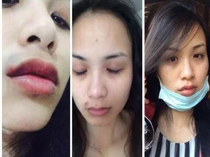 Breaking Silence: Vietnamese Celebrities and the Courage to Speak Out Against Domestic Abuse - image 3