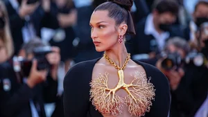 Beauty Standards and Health: The Conversation Around Golden Ratio Faces and Celebrity Wellness - image 7