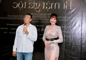 Phi Thanh Van’s Dramatic Aesthetic Journey: Understanding the Transformation and Confidence of Vietnam’s Famous Personality After 21 Procedures - image 3