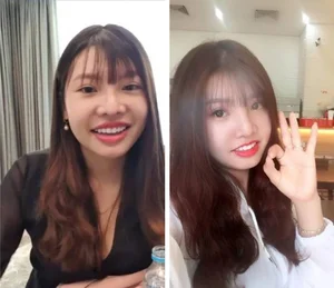 The 6-Year Transformation of Phuong 'Thi No': A Journey of Confidence and Plastic Surgery in Vietnam - image 0