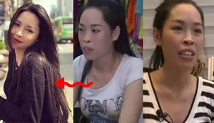 The Incredible Transformation of Vu Thanh Quynh: A Journey Through Plastic Surgery and Renewed Confidence - image 0