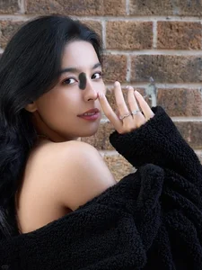 Embracing Unique Beauty: The Inspiring Story of a Fashion Blogger Redefining Standards with Her Birthmark - image 1