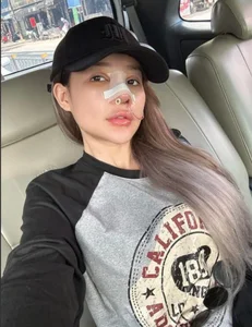 Ngan 98 Beauty Transformation Journey and 12 Nose Surgeries Analysis - image 2