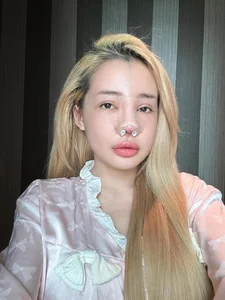 Ngan 98 Beauty Transformation Journey and 12 Nose Surgeries Analysis - image 1