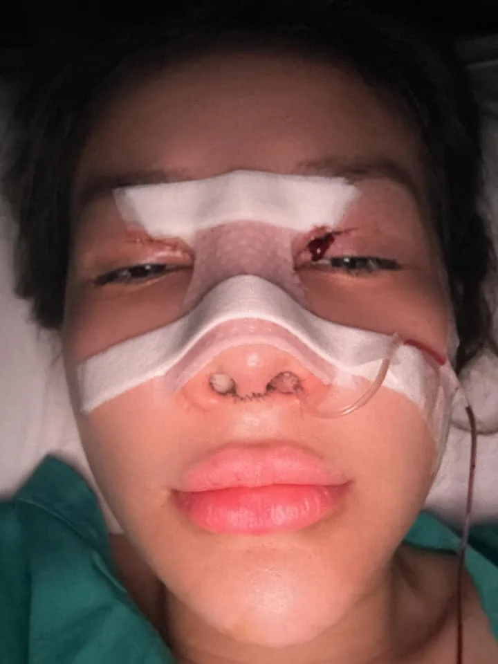 Ngan 98 and the Controversy of Plastic Surgery: Why She Keeps Redefining Her Look