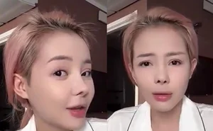 Ngân 98's Beauty Evolution: A Closer Look at Her 12 Rhinoplasty Procedures - image 1
