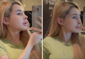 Ngân 98's Beauty Evolution: A Closer Look at Her 12 Rhinoplasty Procedures - image 7