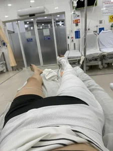 Famous Supermodel Kỳ Hân Sustains Leg Injury While Embracing the Trendy Sport of Pickleball - image 2