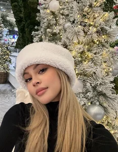 Beyond the Filter: The Resilience and Current Life of the Famous Plump-Lipped Influencer - image 1