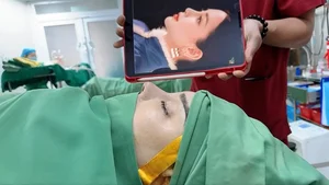 Lâm Khánh Chi’s Continuing Plastic Surgery Journey: Investing in Beauty and Confidence in Her Late 40s - image 0