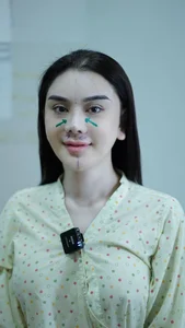 Lâm Khánh Chi’s Continuing Plastic Surgery Journey: Investing in Beauty and Confidence in Her Late 40s - image 3