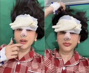 Lâm Khánh Chi’s Continuing Plastic Surgery Journey: Investing in Beauty and Confidence in Her Late 40s - image 2