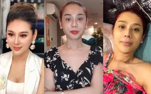 Lâm Khánh Chi’s Continuing Plastic Surgery Journey: Investing in Beauty and Confidence in Her Late 40s - image 1