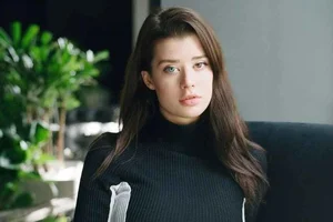 The Rare Beauty of Heterochromia: Celebrating a Stunning Model with Two Different Colored Eyes - image 7