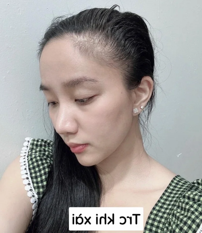Quynh Quynh's Stunning Youthful Photos: Why Le Duong Bao Lam Jokes About Being Jealous