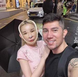 Ngan 98 Plastic Surgery Journey: Exploring the Costs and Transformations of the Famous Vietnamese Influencer - image 6