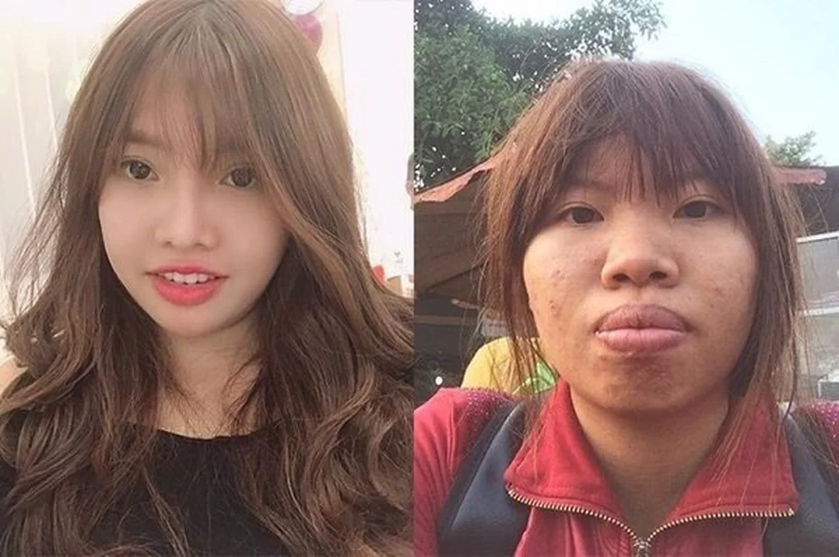 The Remarkable Transformation of Quach Phuong: Six Years After the Overhaul