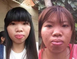 The Remarkable Transformation of Quach Phuong: Six Years After the Overhaul - image 4