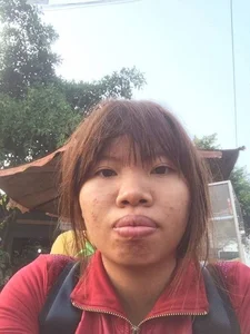The Remarkable Transformation of Quach Phuong: Six Years After the Overhaul - image 2