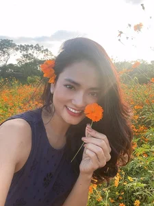 Thuy Hang's Journey of Resilience: Beauty and Strength After 78 Stitches - image 4
