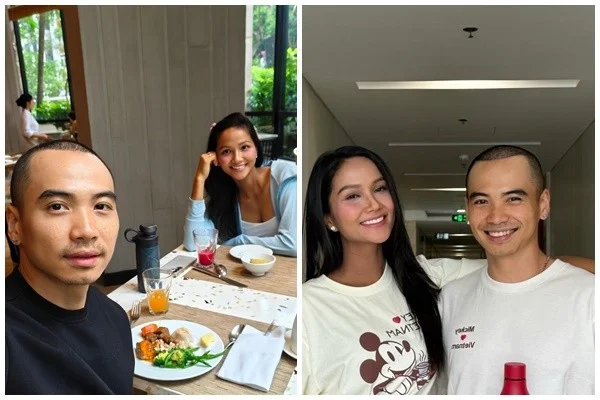 Male Grooming Transformation: The New Look of H'Hen Nie’s Partner After Hair Transplant