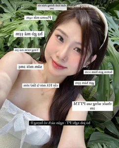 Esports MC Reveals Plastic Surgery Costs and Transformation Journey - image 1